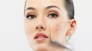 جوانسازی و پاکسازی پوست توسط دکتر ترکاشوند