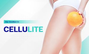 سلولیت و درمان آن توسط دکتر نیلوفر ترکاشوند