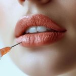 تزریق فیلر اجزای صورت دکتر نیلوفر ترکاشوند 2