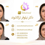 تزریق فیلر خط خنده