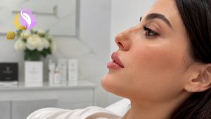 تفاوت ژل لب و فیلر چیست؟ نکات مهم قبل از تزریق فیلر لب