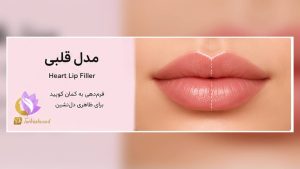عنوان سئو انواع فیلر لب؛ کدام مدل برای فرم صورت شما مناسبتر است؟