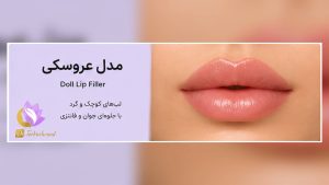 عنوان سئو انواع فیلر لب؛ کدام مدل برای فرم صورت شما مناسبتر است؟
