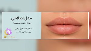 عنوان سئو انواع فیلر لب؛ کدام مدل برای فرم صورت شما مناسبتر است؟