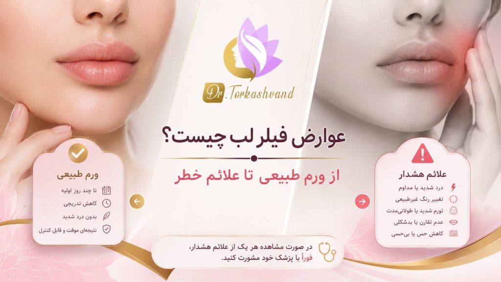 عوارض فیلر لب چیست؟ از ورم طبیعی تا علائم خطر