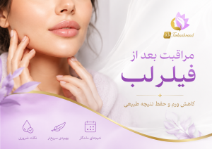 فیلر لب طبیعی چیست؟ راهنمای انتخاب فرم نچرال و شیک