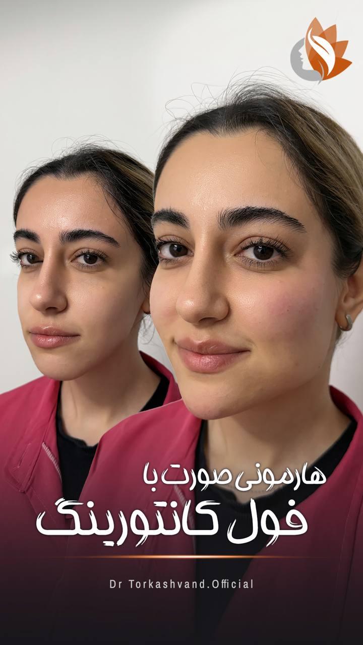 مورد 4#