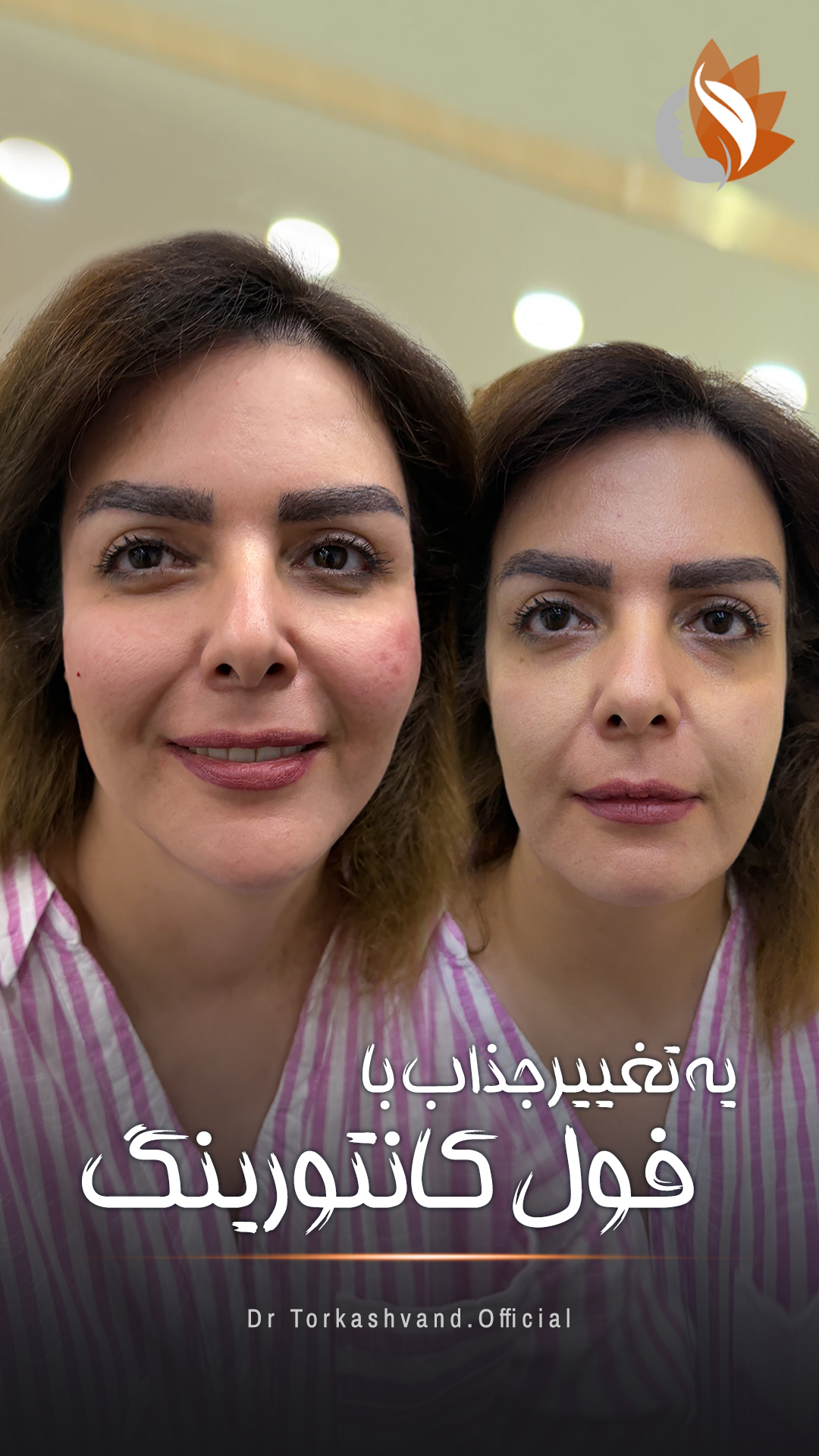 مورد 4#