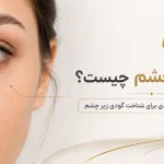 فیلر زیر چشم چیست؟ چه کسانی نتیجه می‌گیرند و چه کسانی نه؟