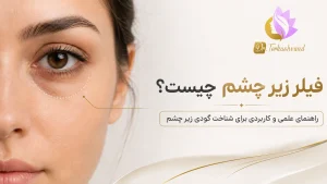 فیلر زیر چشم چیست؟ چه کسانی نتیجه می‌گیرند و چه کسانی نه؟