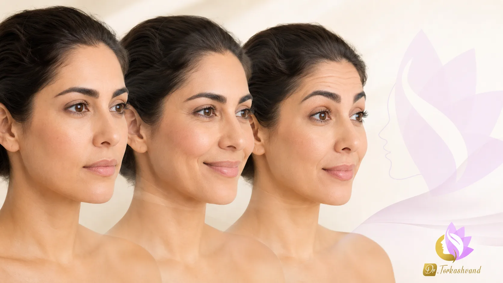 بوتاکس صورت؛ چطور چهرهام مصنوعی نشود؟