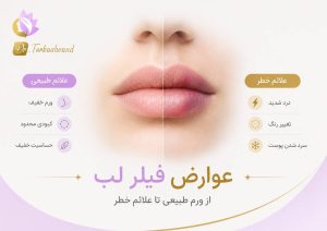 عوارض فیلر لب چیست؟ ورم طبیعی تا علائم خطر