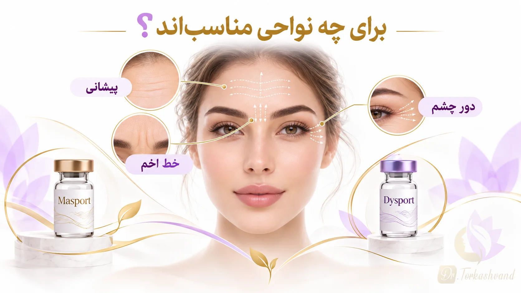 برای پیشانی مصپورت بهتر است یا دیسپورت؟